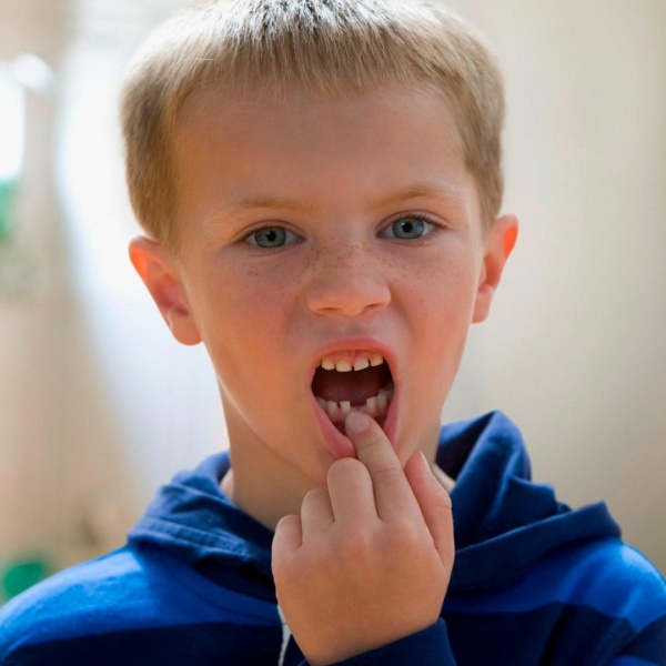 Как помочь ребенку при травме зуба?